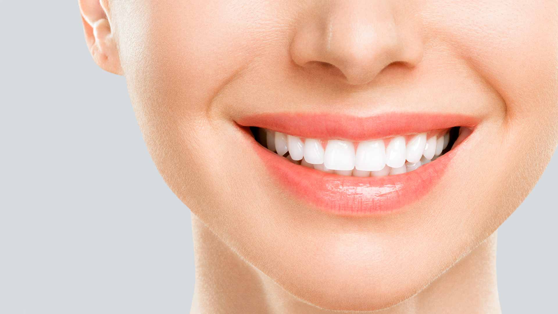 Clareamento Dental